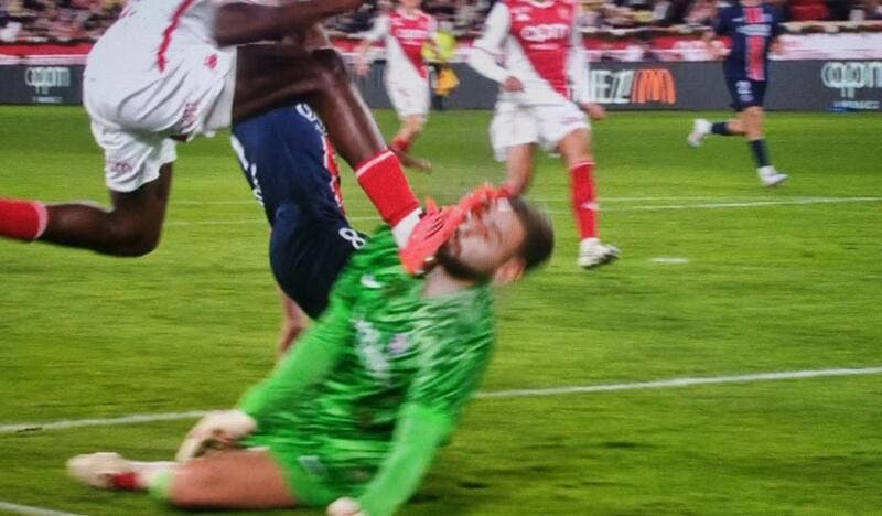  Donnarumma sorti après une violente semelle au visage